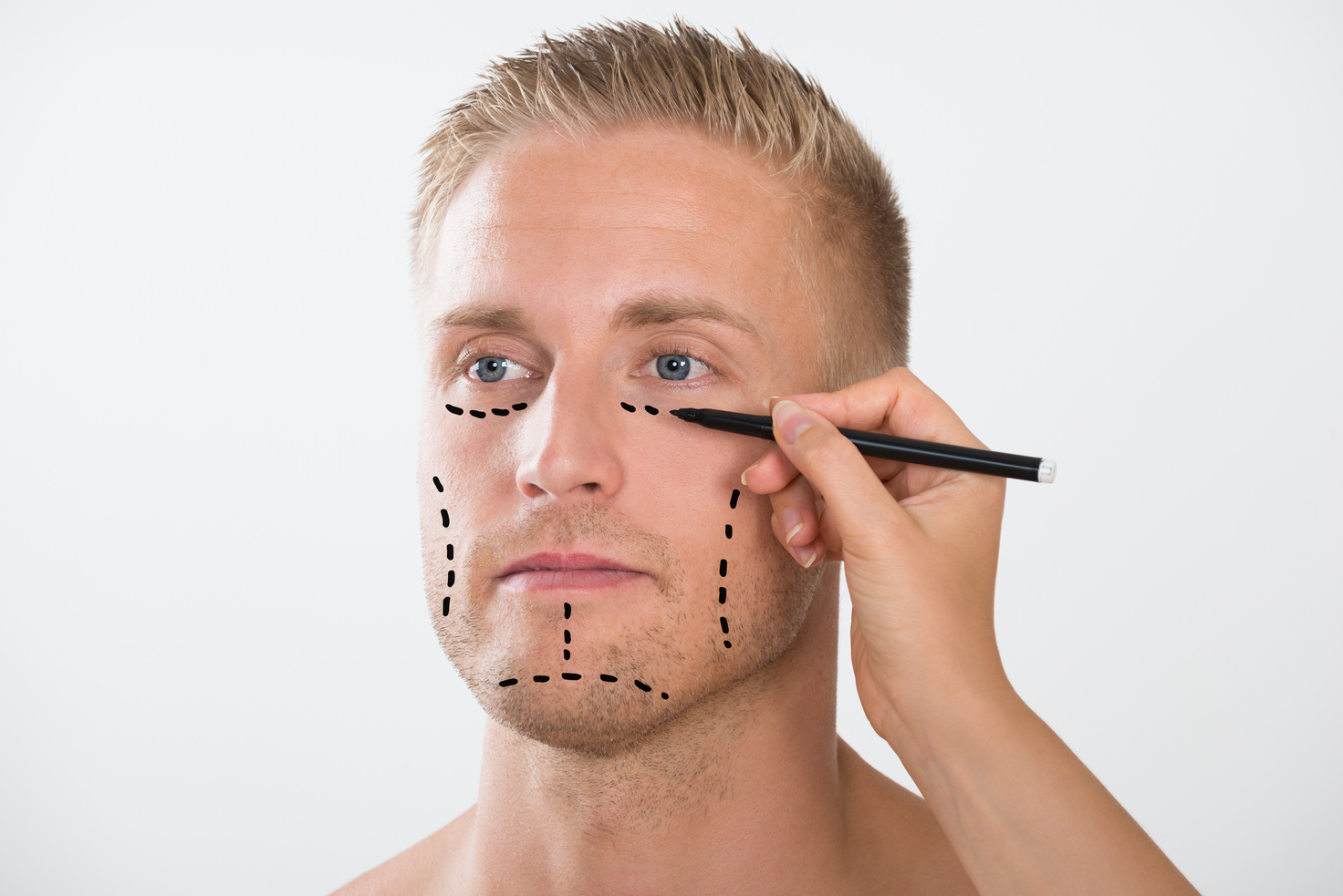 Man With Correction Mark For Plastic Surgery